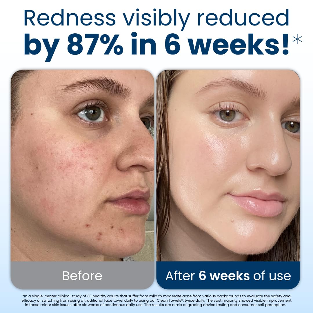 Clean Skin Club Clean Towels XL™, 100% USDA Biobased Face Towel, Disposable Face Towelette, Eczema Association Accepted, Makeup Remover Dry Wipes, Ultra Soft, 50 Ct, 1 Pack