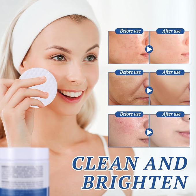 Glycolic Acid Pad, Exfoliating Pads Exfoliating Toner Pads Face Exfoliator Deep Cleaning Effect for Troubled & Breakout-Prone Skin 60 Count