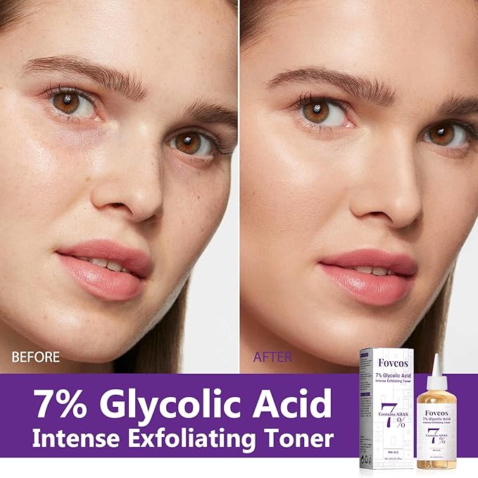 7% Glycolic Acid Exfoliating Toner, Exfoliating Skin Care Facial Toner, Improves Texture, Reduces Breakouts Pores and Fine Lines, Suitable for All Skin Types